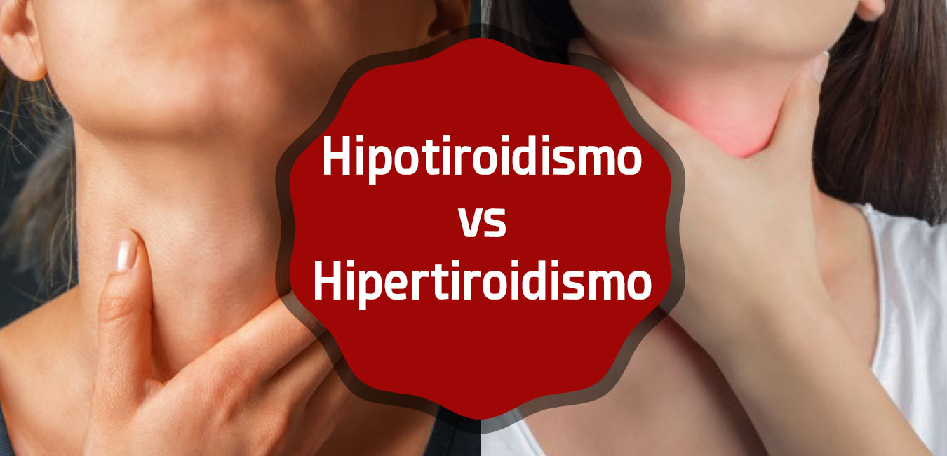 Hipertiroidismo e Hipotiroidismo